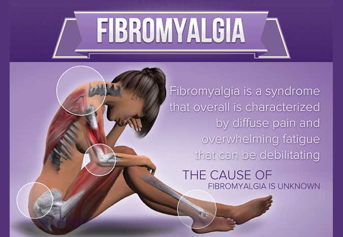 Study: Cannabis Provides Sustained Benefits for Fibromyalgia Patients